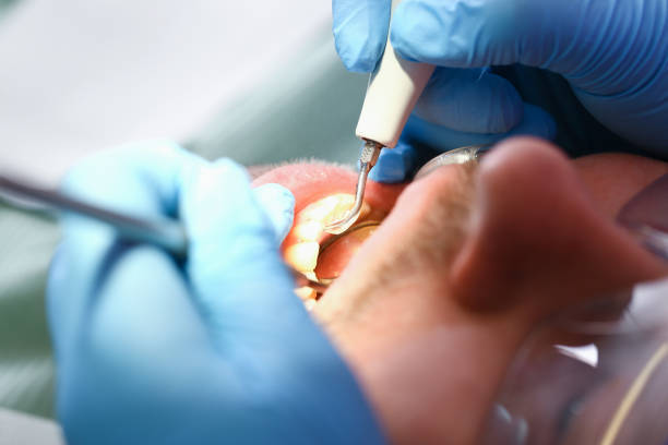 Best Emergency Gum Treatment in Lliams Bay, WI