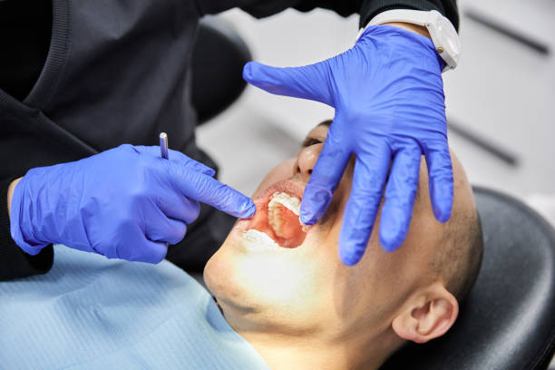Best Emergency Dental Care for Broken or Chipped Teeth in Lliams Bay, WI